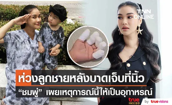 ชมพู่ ธัณย์สิตา เผยระวังมากขึ้นหลังลูกชายบาดเจ็บที่นิ้วมือ