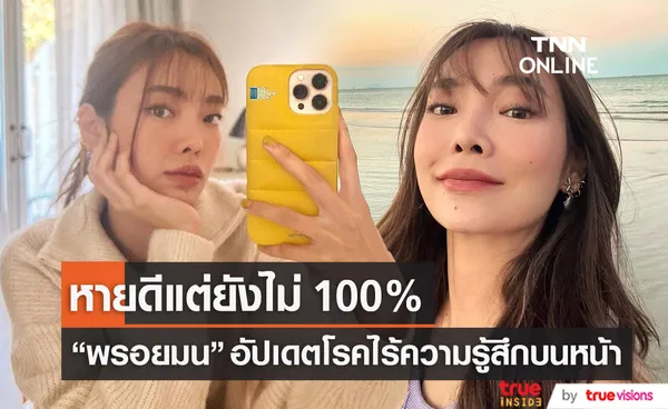 “พรอยมน” หายป่วยโรคหน้าไร้ความรู้สึก แต่ยังไม่ 100 % (มีคลิป)