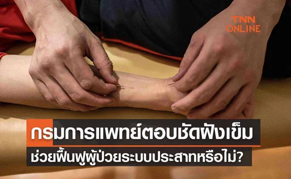 กรมการแพทย์ตอบชัด ‘ฝังเข็ม’ ช่วยฟื้นฟูผู้ป่วยระบบประสาทหรือไม่?