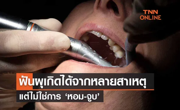 โรคฟันผุ เกิดจากหลายสาเหตุใม่ใช่จากการ ‘หอม-จูบ ’