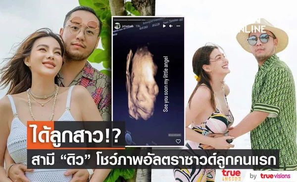 ได้ลูกสาว!? เซบาสเตียน สามี ดิว อริสรา โชว์ภาพอัลตราซาวด์ลูกคนแรก