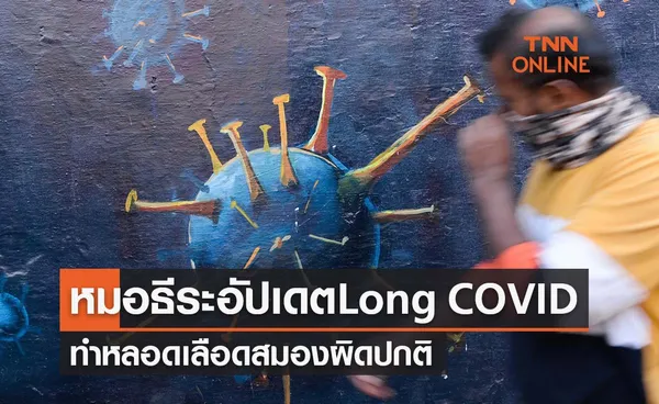 หมอธีระอัปเดตอาการ Long COVID ทำหลอดเลือดสมองผิดปกติ