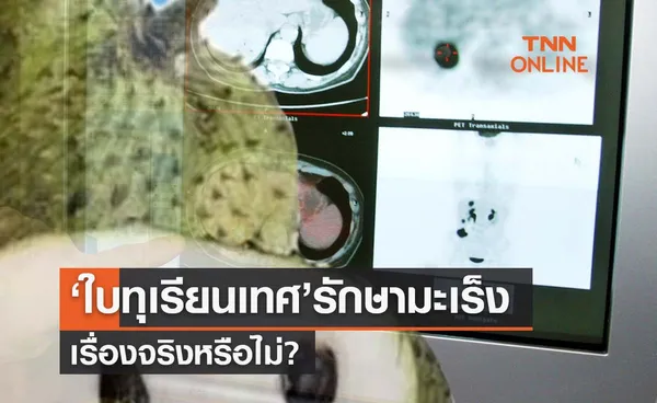 ‘ใบทุเรียนเทศ’ รักษาโรคมะเร็งได้ เรื่องจริงหรือไม่? 