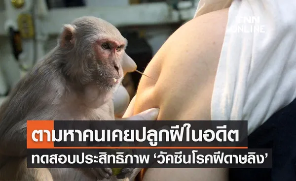 กรมวิทย์ฯ เตรียมหาอาสาสมัครเคย ปลูกฝี ในอดีต ทดสอบวัคซีนโรคฝีดาษลิง