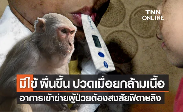 มีไข้ ผื่นหรือตุ่มขึ้น ปวดเมื่อย เช็กอาการเข้าข่ายผู้ป่วยต้องสงสัย ฝีดาษลิง
