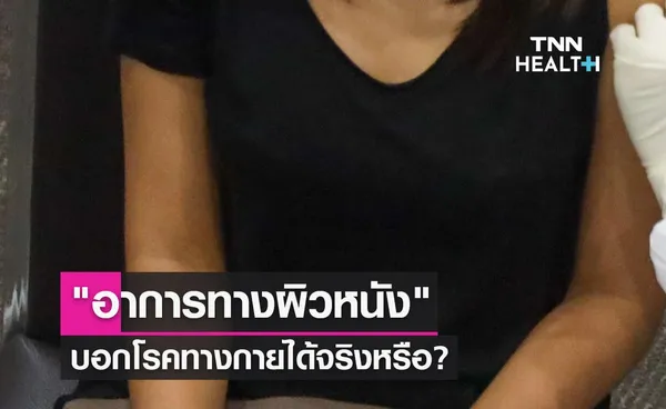 อาการทางผิวหนัง สัญญาณบ่งชี้บอกโรคทางกายได้จริงหรือ?