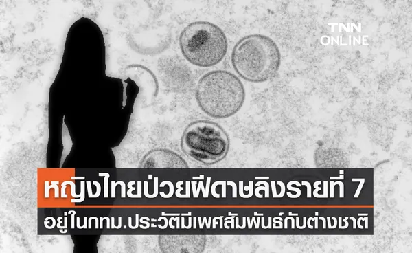 ฝีดาษลิง รายที่ 7 เป็นหญิงไทย อายุ 37 ปี อยู่ในกทม.ใกล้ชิดชายต่างชาติผิวสี