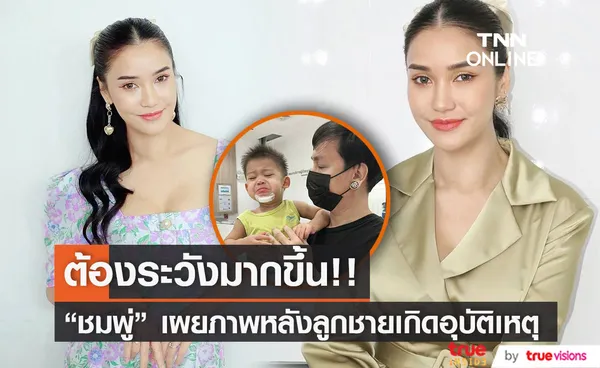 ประสบการณ์ครอบครัว ชมพู่ ธัณย์สิตา เผยภาพลูกชายหลังเกิดอุบัติเหตุ