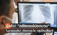 รู้แล้ว คลัสเตอร์ปอดบวม ในอาร์เจนตินา เกิดจากอะไร กลุ่มไหนเสี่ยง?