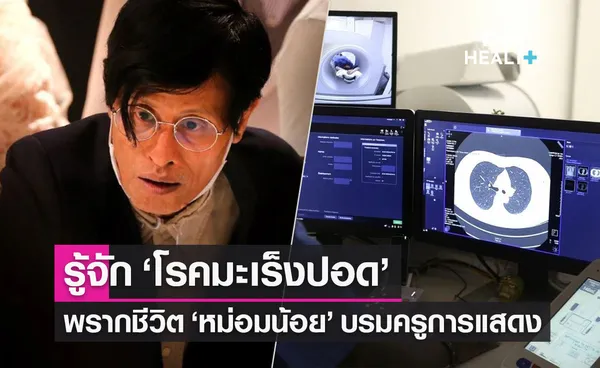 รู้จัก โรคมะเร็งปอด พราก หม่อมน้อย สาเหตุการเสียชีวิตอันดับ 2 ของคนไทย