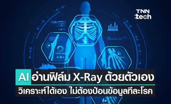 AI ยุคใหม่ เรียนรู้และอ่านฟิล์ม X-Ray ได้เอง ไม่ต้องป้อนข้อมูลทีละโรค