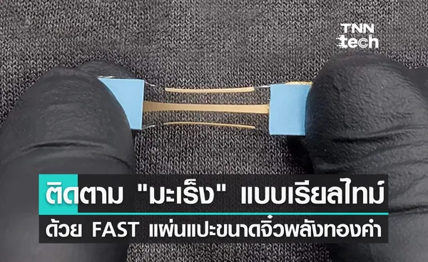 FAST อุปกรณ์ตรวจจับการเติบโตของมะเร็ง พร้อมรายงานผลแบบเรียลไทม์บนสมาร์ตโฟน