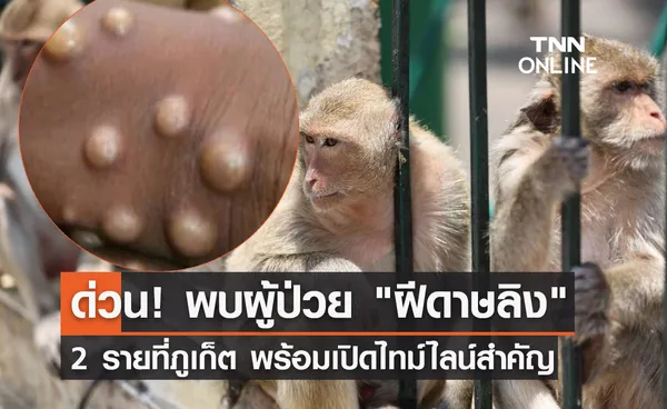 ด่วน! พบผู้ป่วย โรคฝีดาษลิง 2 รายที่ภูเก็ต พร้อมเปิดไทม์ไลน์สำคัญ