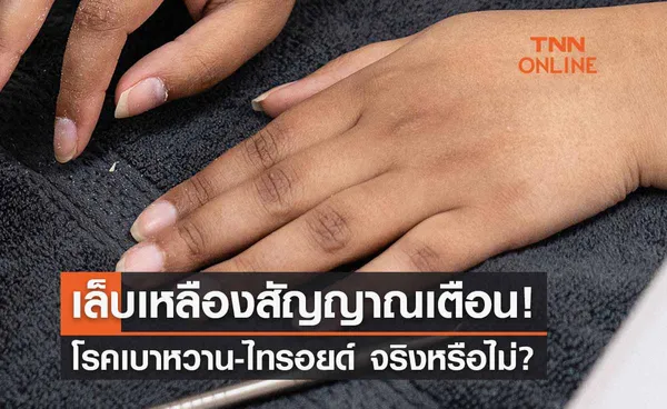 เล็บเหลือง? สัญญาณเตือนเบาหวาน-ไทรอยด์ จริงหรือไม่?