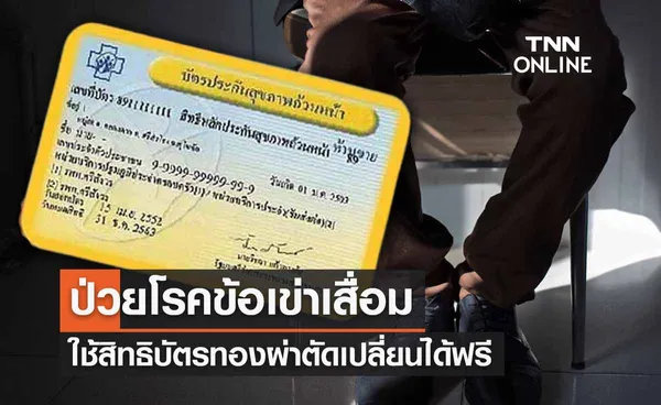 เช็กสิทธิบัตรทอง ‘โรคข้อเข่าเสื่อม’ ผ่าตัดเปลี่ยนได้ฟรี 