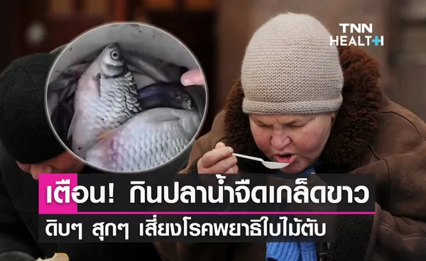 ระวัง! กินปลาน้ำจืดเกล็ดขาว ดิบๆ สุกๆ เสี่ยงโรคพยาธิใบไม้ตับ