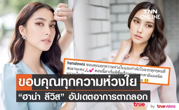 ฮาน่า ลีวิส ขอบคุณทุกกำลังใจ อัปเดตกระจกตาถลอกใกล้หายแล้ว 