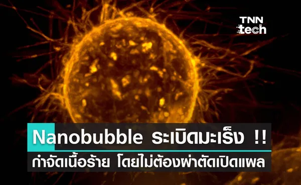 Nanobubble กำจัดก้อนมะเร็งด้วยการ ระเบิด โดยไม่ต้องผ่าตัดเปิดแผล