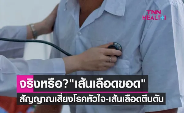 เส้นเลือดขอด สัญญาณเสี่ยงโรคหัวใจ-เส้นเลือดตีบตันจริงหรือ?