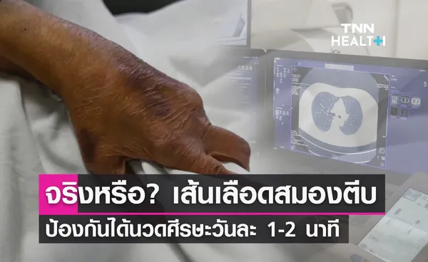 เส้นเลือดสมองตีบ! นวดศีรษะวันละ 1-2 นาทีป้องกันได้ จริงหรือ?