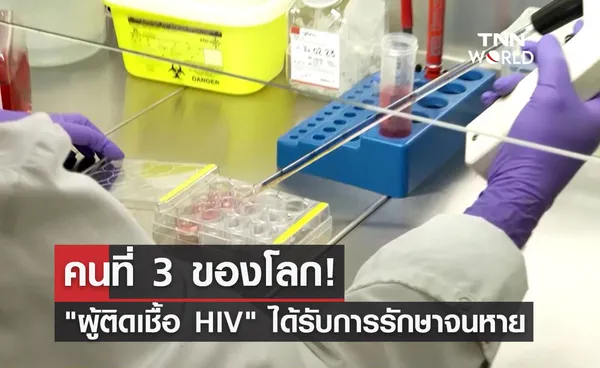 ผู้ติดเชื้อ HIV ได้รับการรักษาจนหายเป็นคนที่ 3 ของโลก ด้วยวิธีนี้?