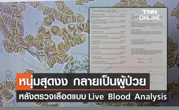 เป็นแสน! หนุ่มสุดงง กลายเป็นผู้ป่วยหลังตรวจเลือดแบบ Live Blood Analysis