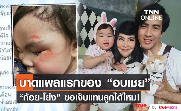 ก้อย-โย่ง สงสารลูกจับใจ น้องอบเชย ล้มหน้าไถล!!