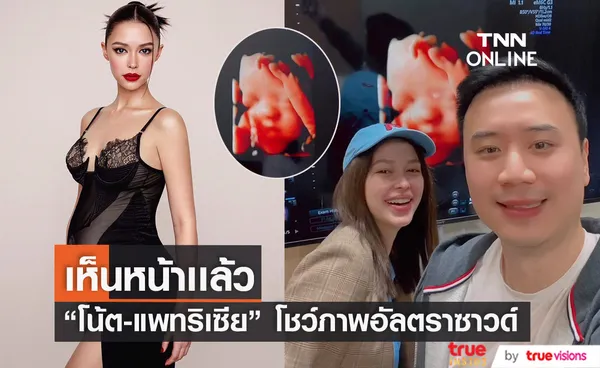 “โน้ต - แพทริเซีย” โชว์หน้าลูกสาวแบบชัด แก้มอ้วนๆน่ารักสุดๆ 