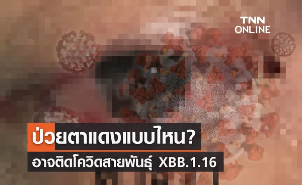 หมอมนูญเผยป่วยตาแดงแบบไหน? อาจติดโควิดสายพันธุ์ XBB.1.16 