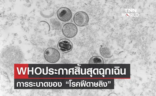 อนามัยโลกประกาศสิ้นสุดฉุกเฉิน “ฝีดาษลิง”หลังระบาดปีที่แล้ว 