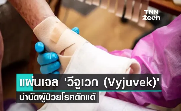 แผ่นเจลบำบัด ‘Vyjuvek’ นวัตกรรมรักษาโรคดักแด้