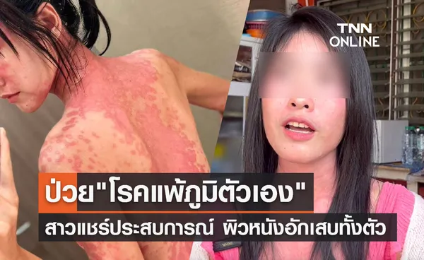 แคดดี้สาวแชร์ประสบการณ์ป่วย โรคแพ้ภูมิตัวเอง แนะใช้ชีวิตอย่างมีสติ