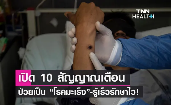 เปิด 10 สัญญาณเตือนการเกิด “โรคมะเร็ง” รู้เร็ว-รักษาไว มีโอกาสหายขาด