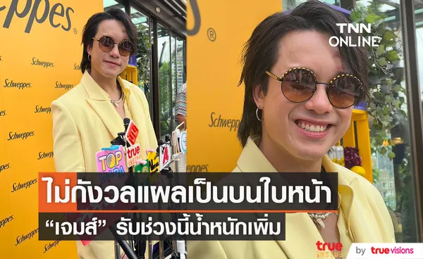 เจมส์ ธีรดนย์ ไม่กังวลหน้าเป็นแผลใหญ่ รับช่วงนี้น้ำหนักเพิ่ม