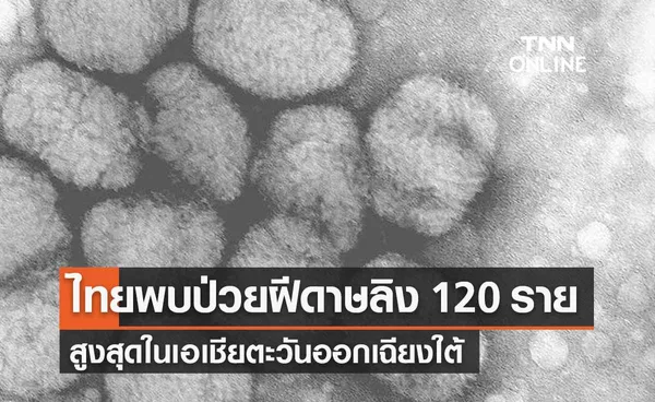 หมอยงเผยไทยพบผู้ป่วยฝีดาษลิง 120 ราย สูงสุดในเอเชียตะวันออกเฉียงใต้ 