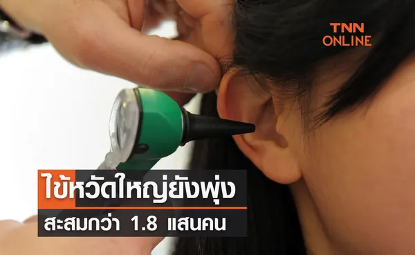 ไข้หวัดใหญ่ยังพุ่ง สะสมกว่า 1.8 แสนคน