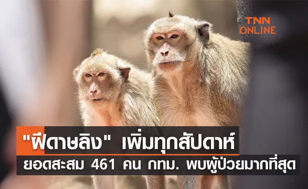 ฝีดาษลิงเพิ่มทุกสัปดาห์ ยอดสะสม 461 คน