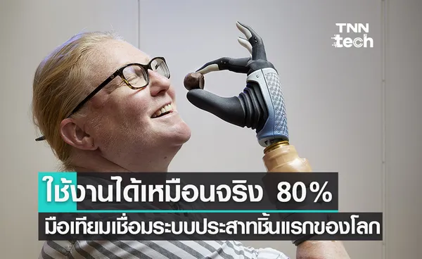 มือเทียมเชื่อมต่อระบบประสาทโดยตรงชิ้นแรกของโลก ใช้งานได้เหมือนจริง 80%