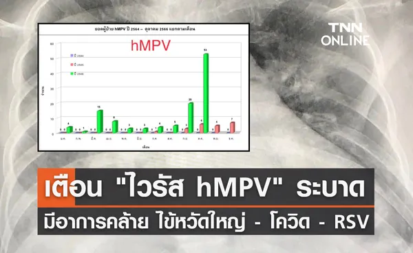 ไวรัส hMPV ระบาด! หมอมนูญ เผยเคสผู้ป่วย มีอาการคล้ายไข้หวัดใหญ่-โควิด-RSV