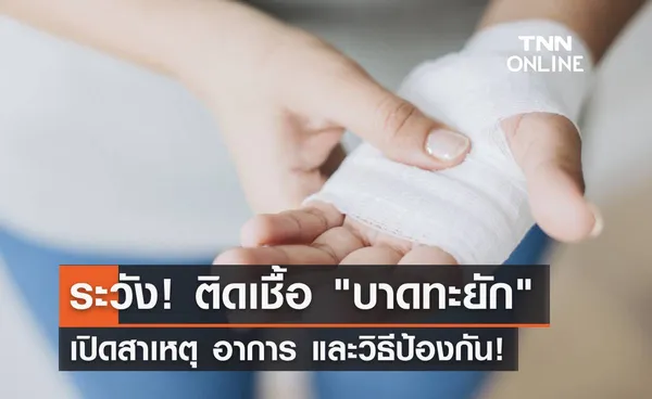 บาดทะยัก โรคติดเชื้อที่ต้องระวัง เปิดสาเหตุ อาการ และวิธีป้องกัน เช็คเลย!