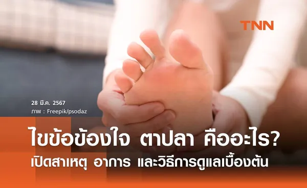 ไขข้อข้องใจ ตาปลา คืออะไร เปิดสาเหตุ อาการ และวิธีการดูแลเบื้องต้น