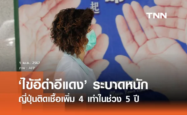 ‘ไข้อีดำอีแดง’ ญี่ปุ่นระบาดหนัก ติดเชื้อพุ่ง 4 เท่า ‘ล้างมือ’ ป้องกันได้ 