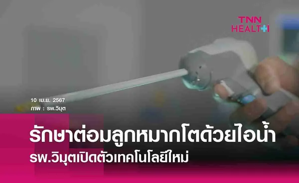 รพ.วิมุตเปิดตัวเทคโนโลยีใหม่ รักษาต่อมลูกหมากโตด้วยไอน้ำ