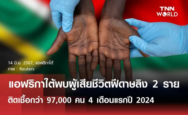 แอฟริกาใต้พบผู้เสียชีวิตฝีดาษลิง 2 ราย ติดเชื้อกว่า 97,000 คน