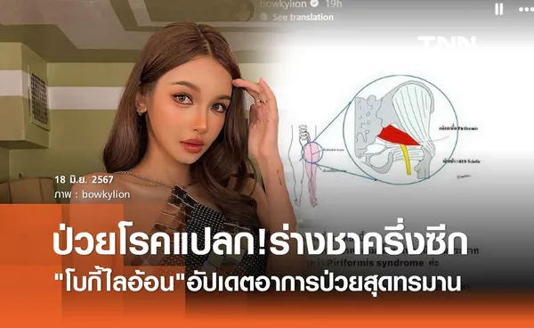 โบกี้ไลอ้อน รับสุดทรมาน ป่วยโรคแปลก! ชาครึ่งซีก จนกลายเป็นเดินไม่ได้