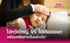 ความแตกต่างระหว่าง ไข้หวัดใหญ่ VS ไข้เลือดออก 