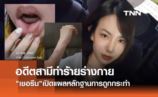 ช็อก! เชอรีน น้องสาว นิชคุณ เปิดบาดแผลถูกอดีตสามีทำร้าย เข้าแจ้งความหวั่นความปลอดภัย