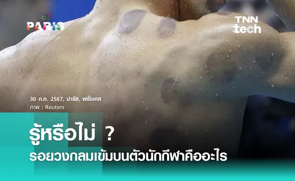 รอยวงกลมเข้มบนตัวนักกีฬาคืออะไร ?