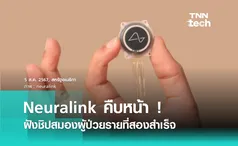 Neuralink เผย ! ปลูกถ่ายชิปในสมองผู้ป่วยรายที่สองเรียบร้อยแล้ว