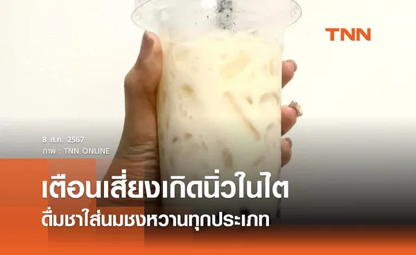 ดื่มชาใส่นมชงหวานทุกประเภท กรมอนามัย เตือนเสี่ยงเกิดนิ่วในไต